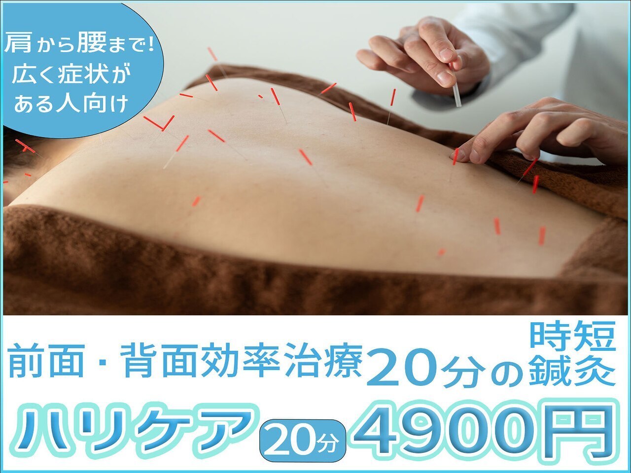 頚椎症、五十肩、頭痛、肩こり、腰痛、膝痛、不眠、倦怠感、生理痛、坐骨神経痛、寝違え、ぎっくり腰、等の原因の部位に直接アプローチするためすぐに効果を実感して頂ける渋谷駅近くにあるreCare道玄坂鍼灸院にて提供しているハリケアのイメージ