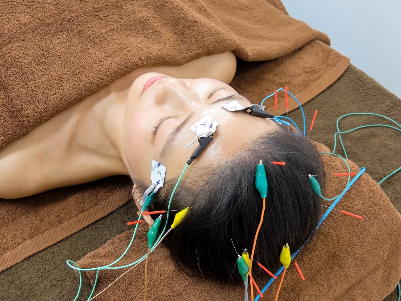 頭痛、肩こり、眼精疲労、不眠症、睡眠障害、倦怠感、慢性疲労症候群等でお悩みの患者様に鍼と睡眠を掛け合わせることで生産性向上を実現することを可能にした渋谷駅近くにあるreCare道玄坂鍼灸院にて提供しているハリミンの画像