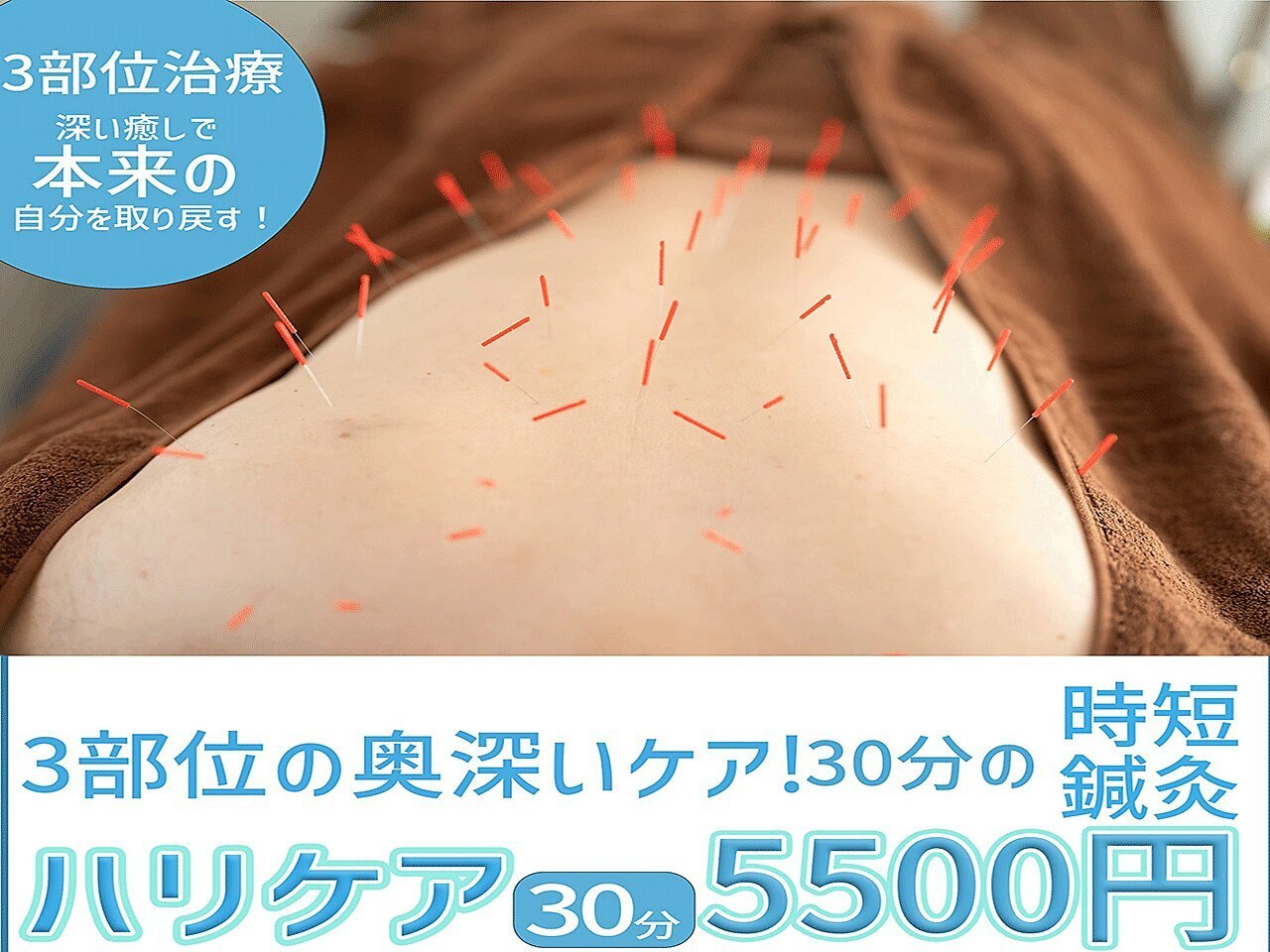 頚椎症、五十肩、頭痛、肩こり、腰痛、膝痛、不眠、倦怠感、生理痛、坐骨神経痛、寝違え、ぎっくり腰、等への施術が最短10分から受けられるため、１日2回、隙間時間でも受けられることを可能にした渋谷駅近くにあるreCare道玄坂鍼灸院にて提供しているハリケアのイメージ
