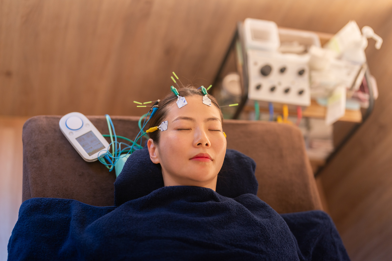 頭痛、肩こり、眼精疲労、不眠症、睡眠障害、倦怠感、慢性疲労症候群等でお悩みの患者様が抱える脳疲労を回復させることを可能にした渋谷駅近くにあるreCare道玄坂鍼灸院にて提供しているハリミンをしている画像