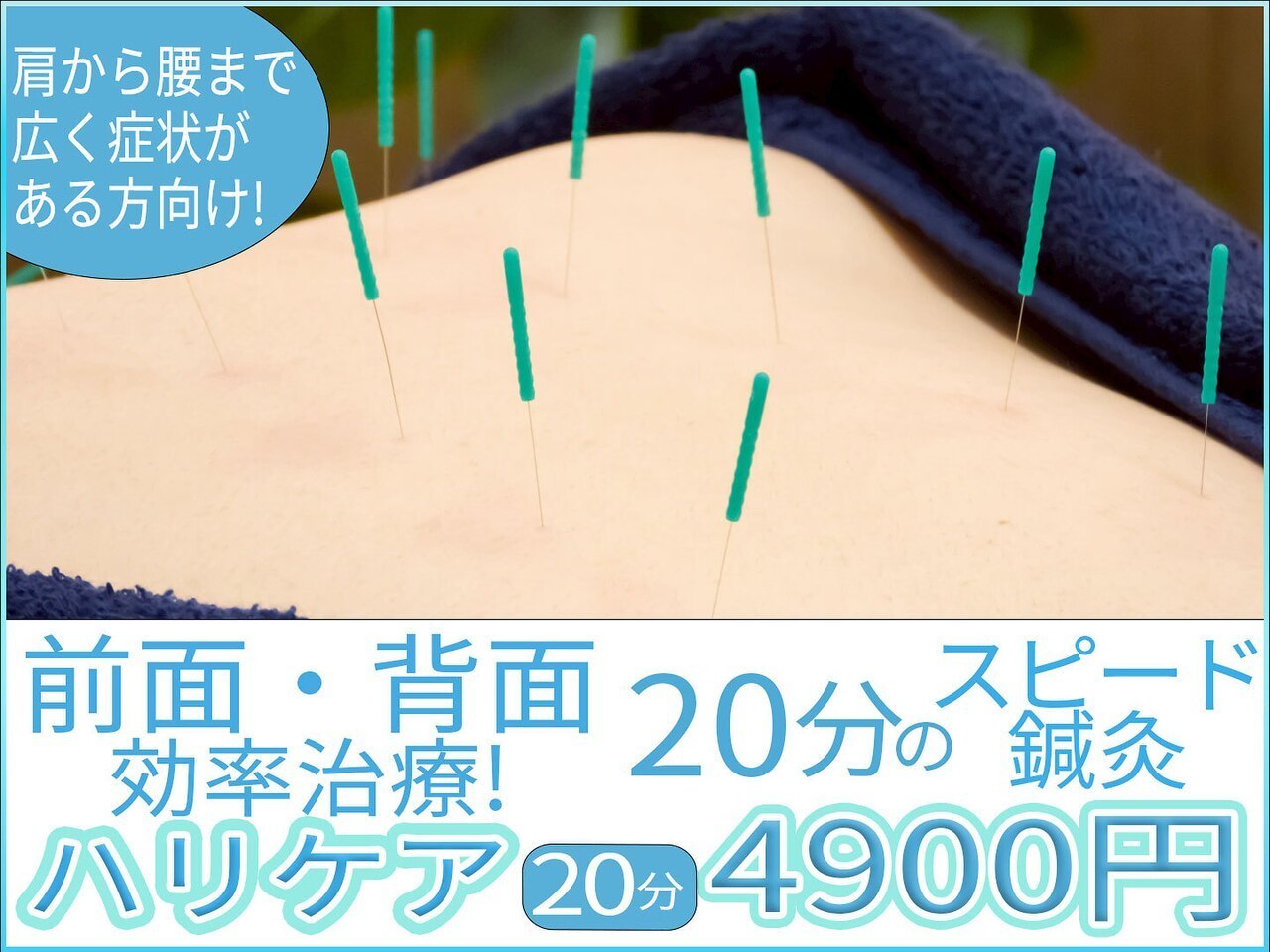 頚椎症、五十肩、頭痛、肩こり、腰痛、膝痛、不眠、倦怠感、生理痛、坐骨神経痛、寝違え、ぎっくり腰、等の原因の部位に直接アプローチするためすぐに効果を実感して頂ける渋谷駅近くにあるreCare道玄坂鍼灸院にて提供しているハリケアのイメージ